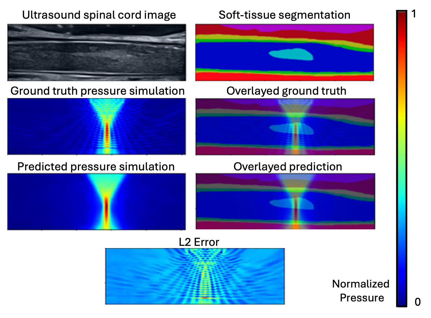 Neural Operator Result